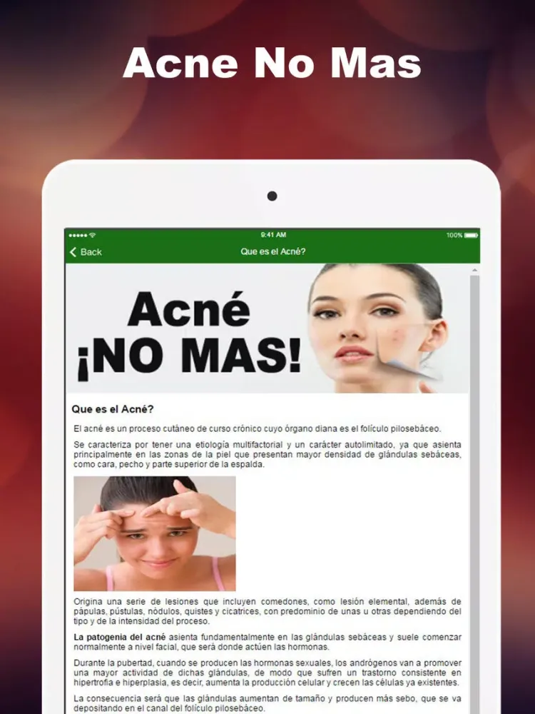 Acne No Mas: Consejos Para Eliminar Acne Del Todo iPad  Screenshots