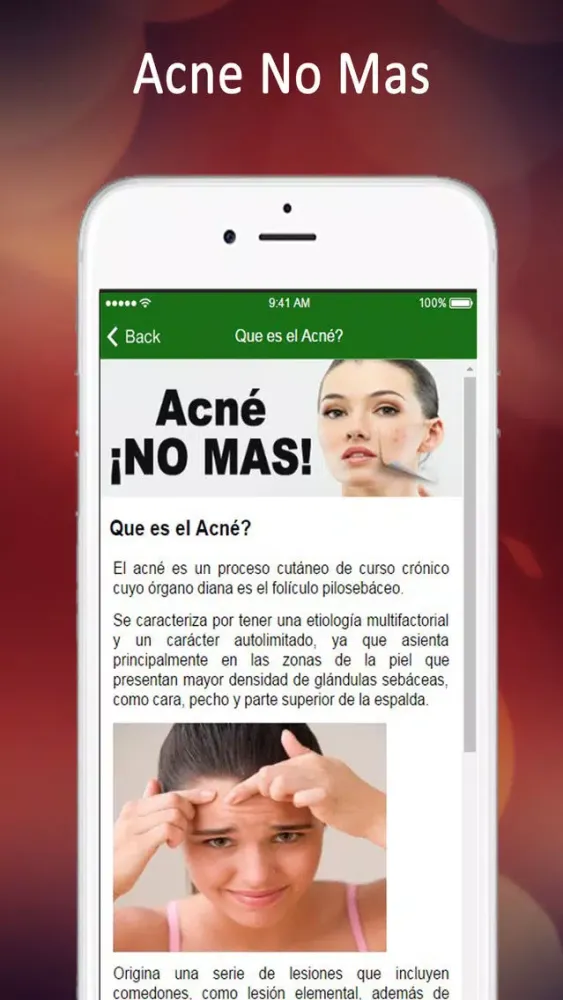 Acne No Mas: Consejos Para Eliminar Acne Del Todo Screenshots