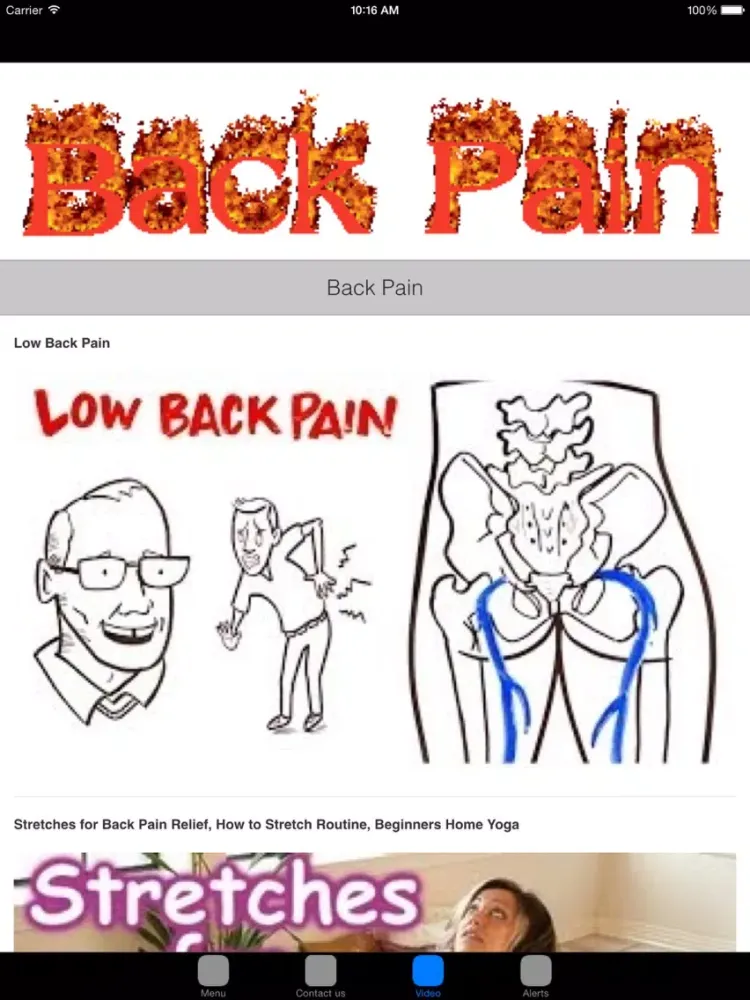 Lower Back Pain & Back Pain Treatment iPad 应用截图
