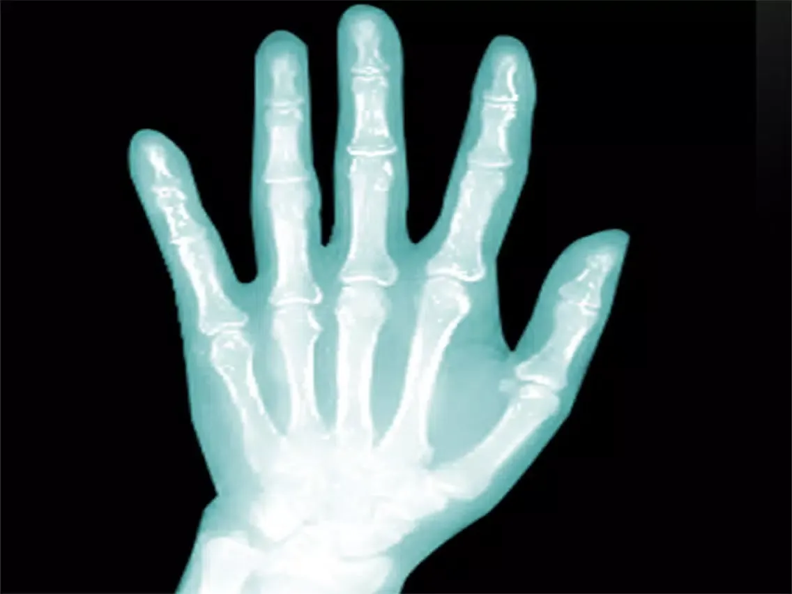 Capturas de pantalla de X-Ray Scanner -free iPad 