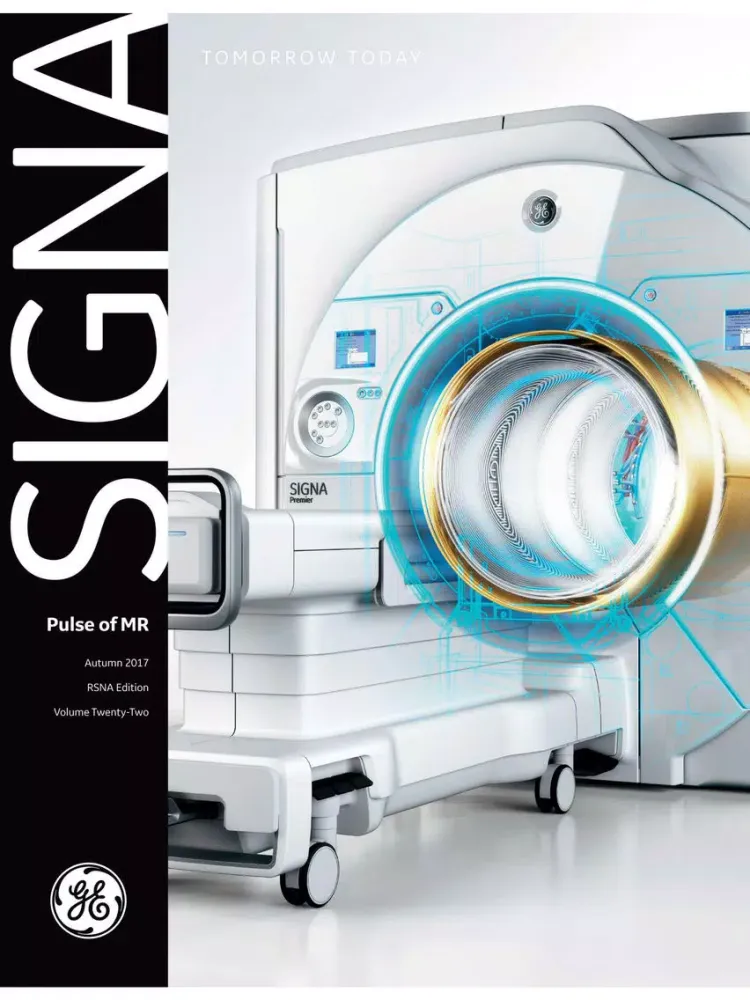 Zrzuty ekranu GE Healthcare SIGNA Pulse iPad 