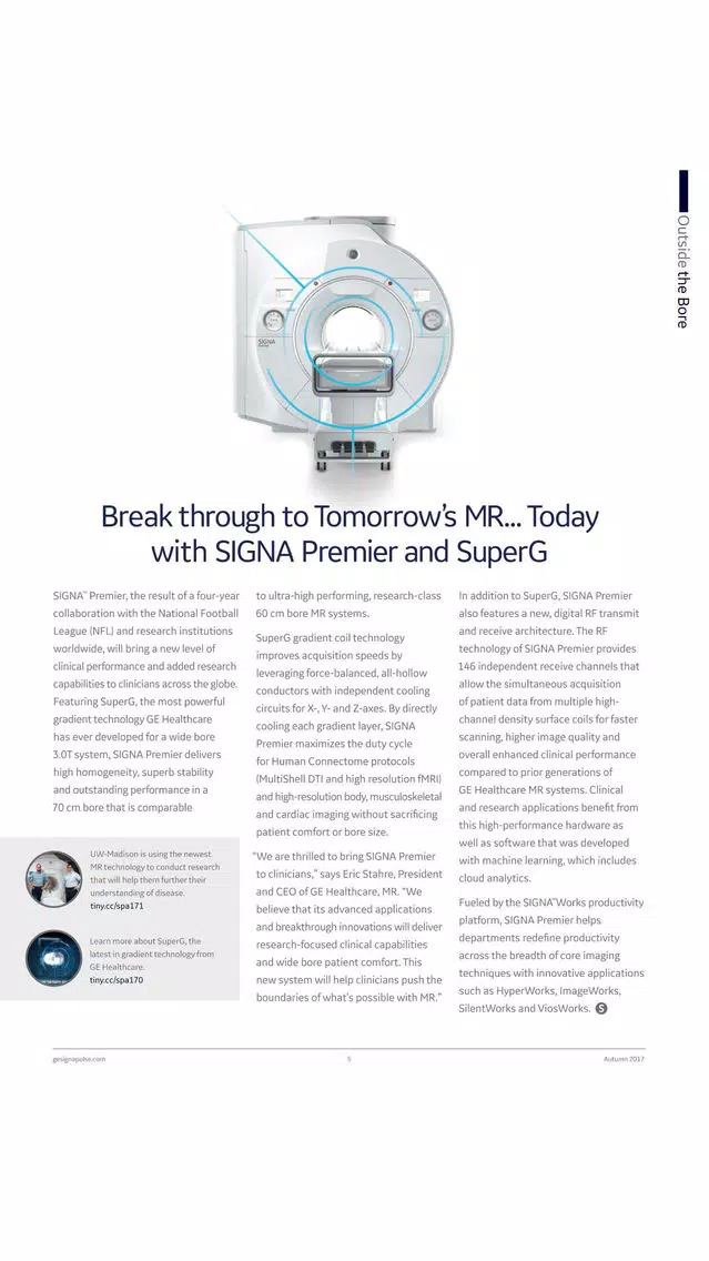 GE Healthcare SIGNA Pulse スクリーンショット