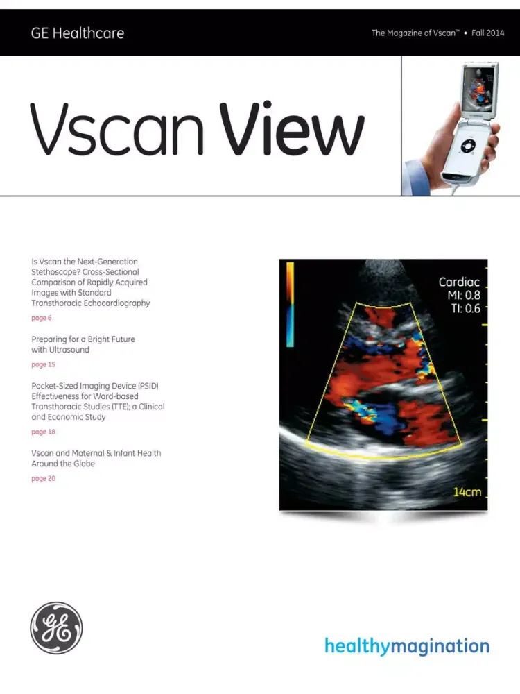 صور GE Healthcare Vscan View iPad 