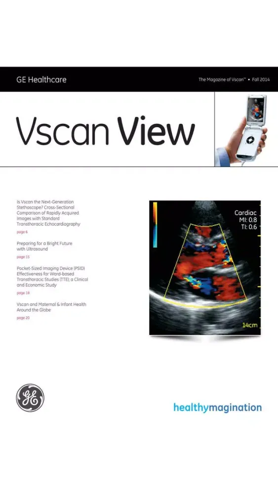 صور GE Healthcare Vscan View