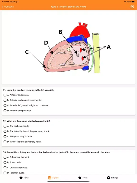 صور The Goofy Anatomist iPad 