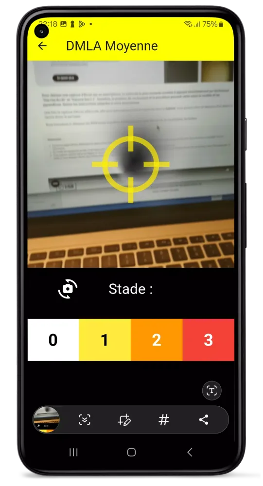 Loupe Dmla Screenshots