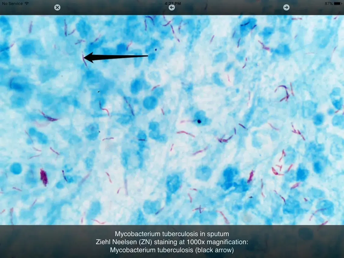 Capturas de pantalla de Bacterial Infections iPad 