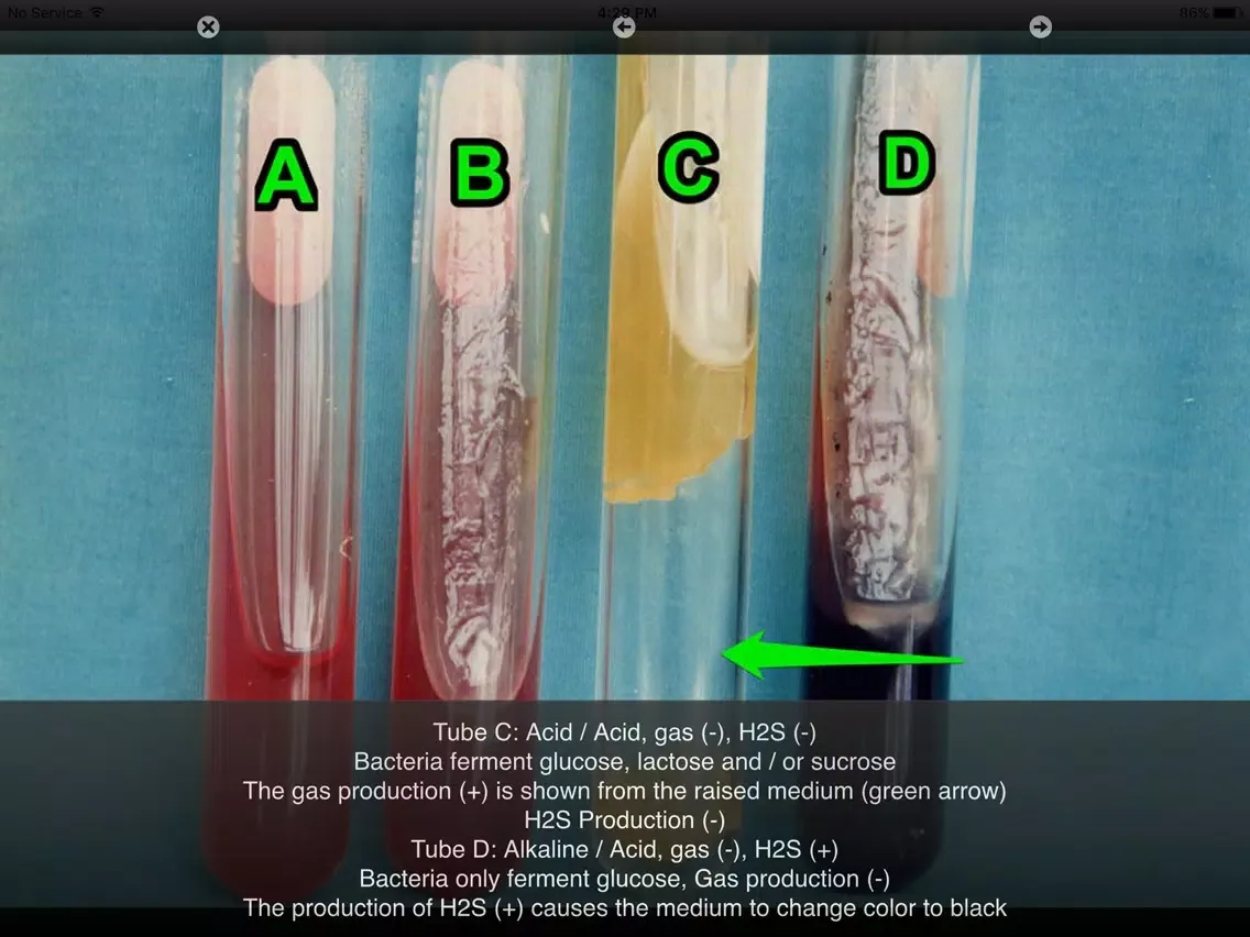 Capturas de pantalla de Bacterial Infections iPad 