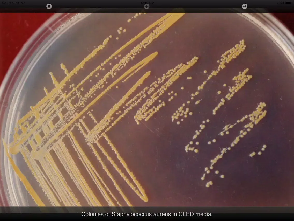 Capturas de pantalla de Bacterial Infections iPad 