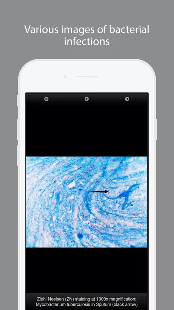 Capturas de pantalla de Bacterial Infections