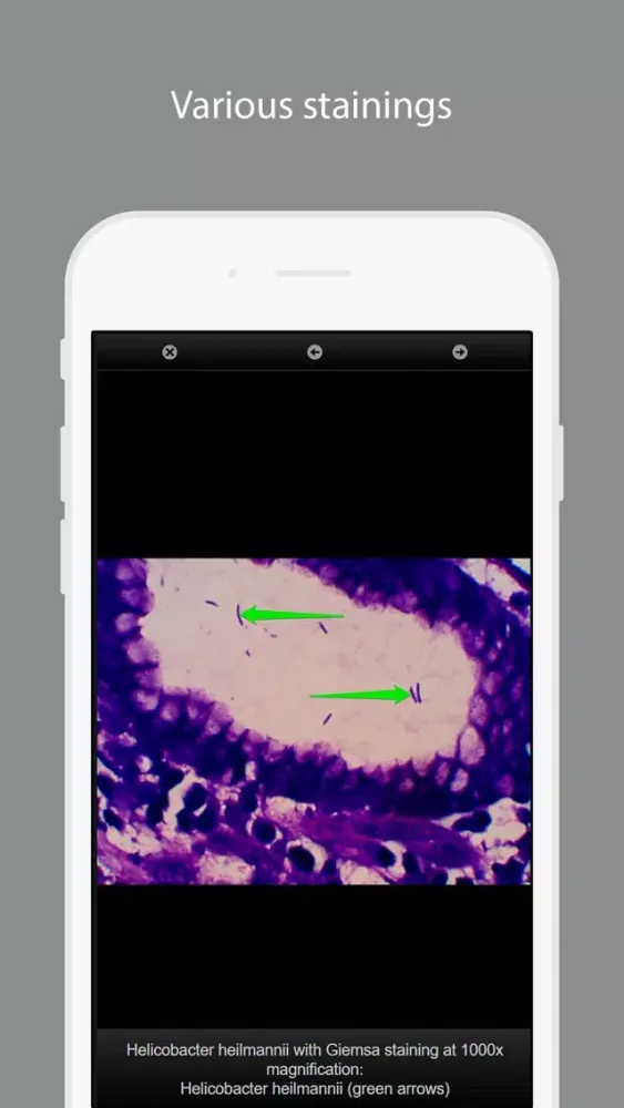 Capturas de pantalla de Bacterial Infections