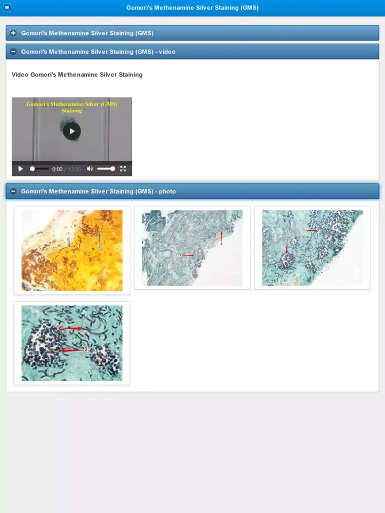 Stainings in Medical Mycology iPad  Screenshots