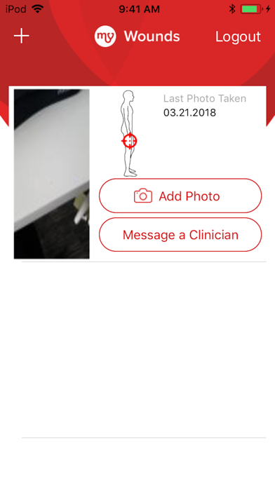 Tangkapan skrin MyWoundDoctor - Patient