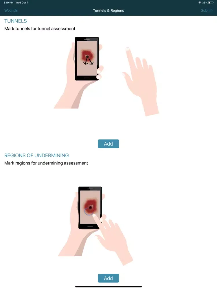 iWound Care iPad  Screenshots