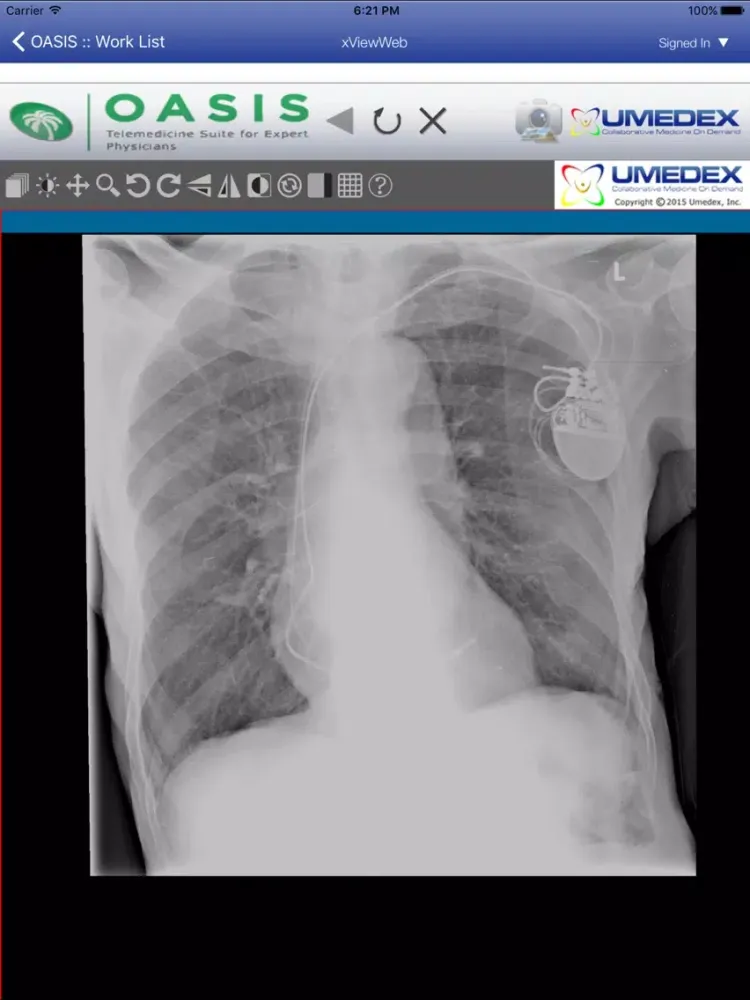 UMEDEX OASIS Telemedicine Suite iPad  স্ক্রিনশট