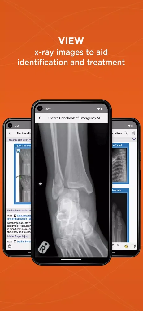 Oxford Emergency Medicine Screenshots