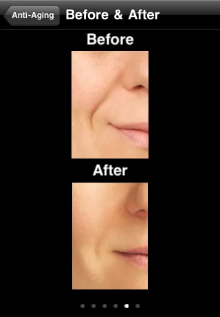 Capturas de pantalla de Scar Removal