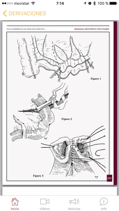 Atlas Quirúrgico de Urología स्क्रीनशॉट