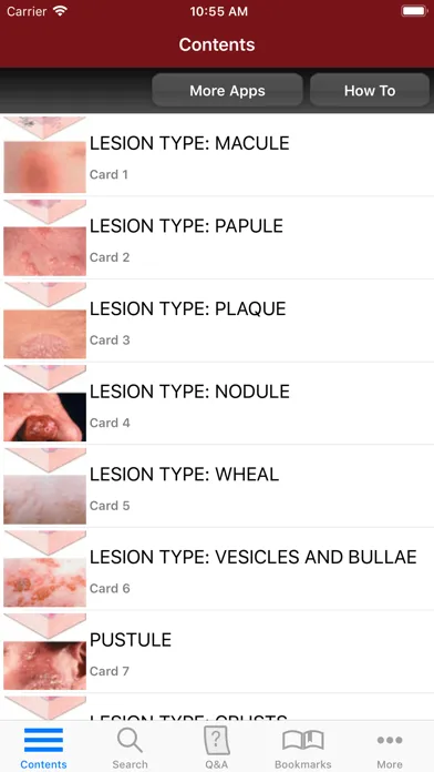 صور Fitzpatrick's Derm Flash Cards