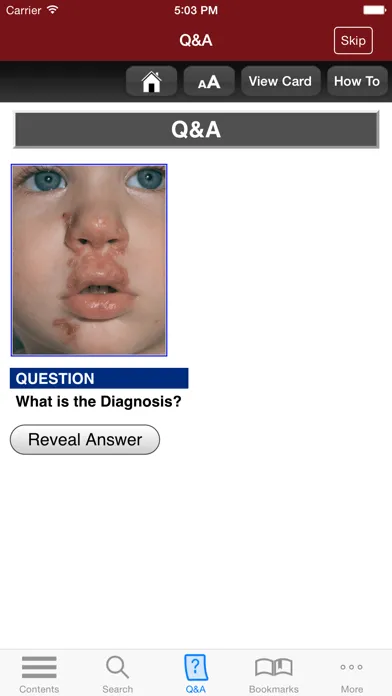 صور Fitzpatrick's Derm Flash Cards