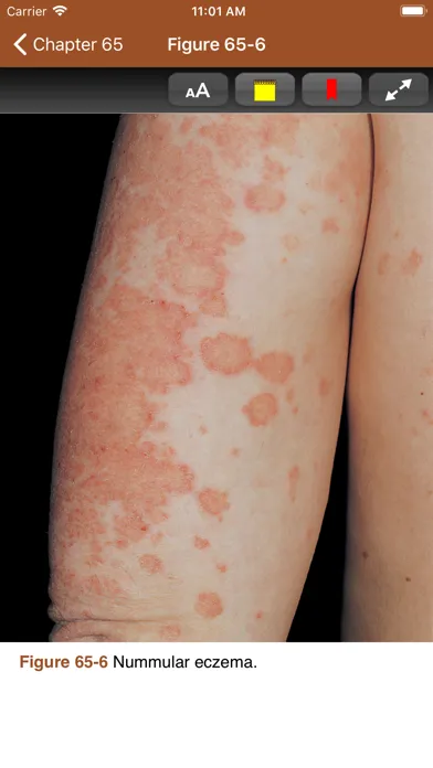 Capturas de tela do Johns Hopkins Internal Med 5/E