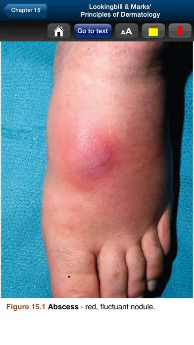 Lookingbill & Marks' Derm. 5E Screenshots
