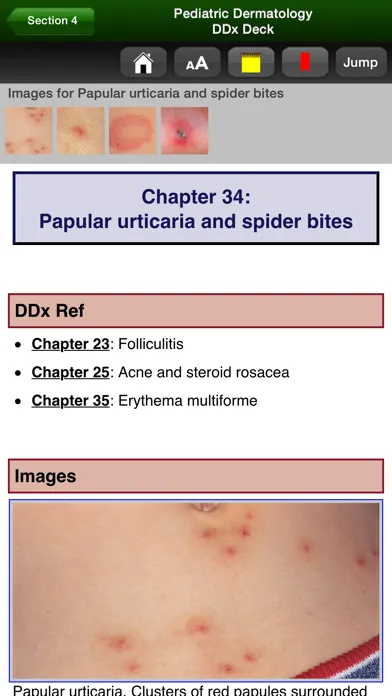 تصاویر Pediatric Dermatology DDx Deck