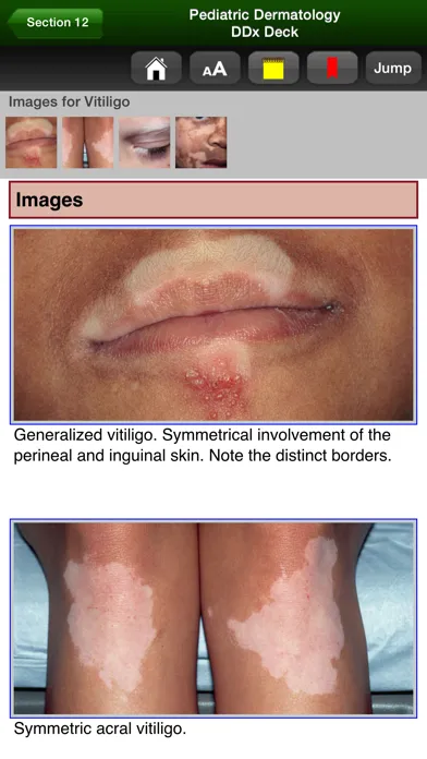 تصاویر Pediatric Dermatology DDx Deck