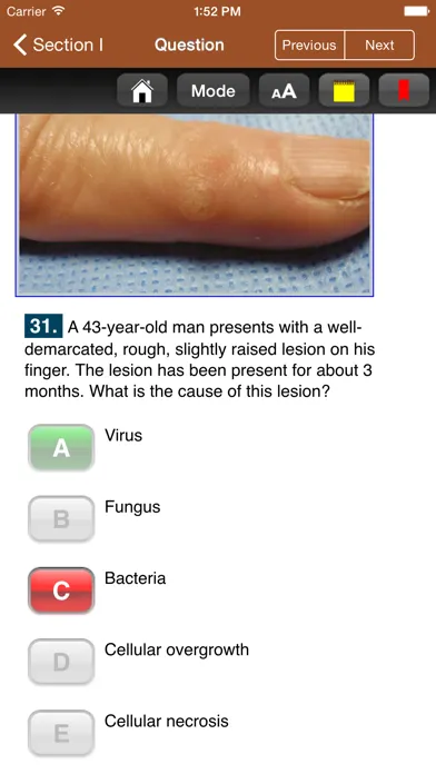 Capturas de tela do USMLE Images for the Boards