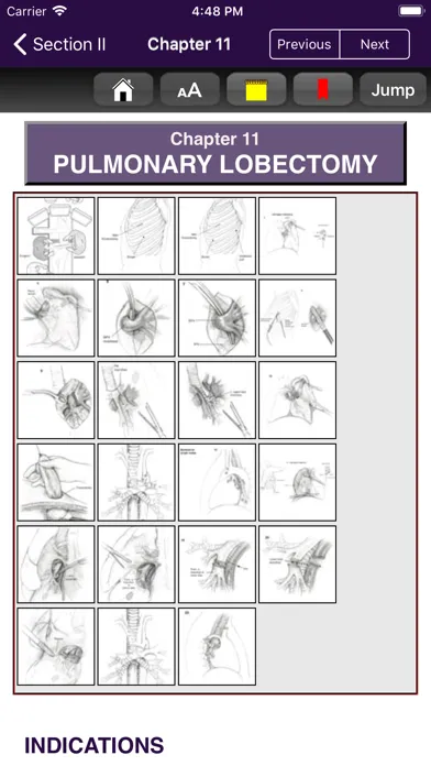 Zrzuty ekranu Atlas of Min. Invasive Surgery