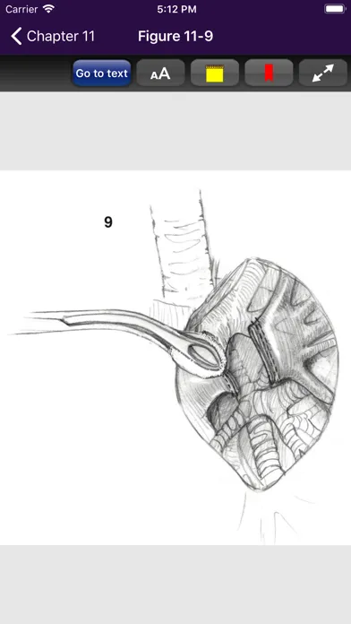 Zrzuty ekranu Atlas of Min. Invasive Surgery