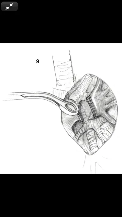 Zrzuty ekranu Atlas of Min. Invasive Surgery