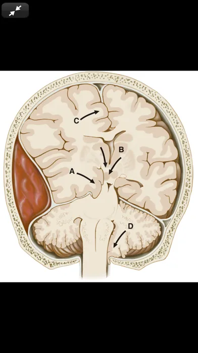 Harrison’s Manual of Med. 20/E Screenshots
