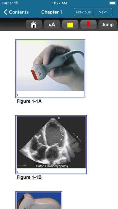 Скриншоты Atlas Emergency Ultrasound, 2E