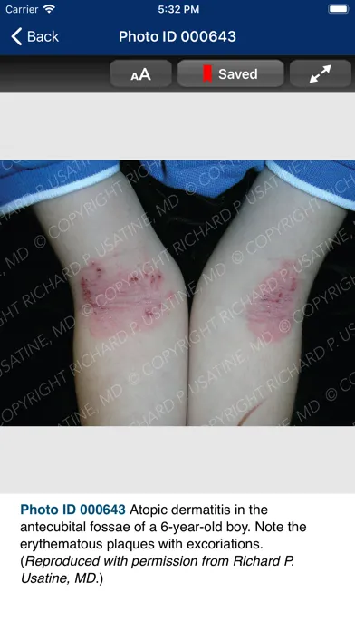 Ảnh chụp màn hình của Usatine Medical Photo Library