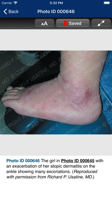 Ảnh chụp màn hình của Usatine Medical Photo Library