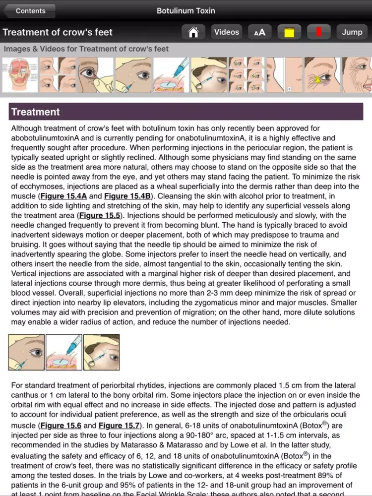 Ảnh chụp màn hình của Botulinum Toxin, 3rd Edition iPad 