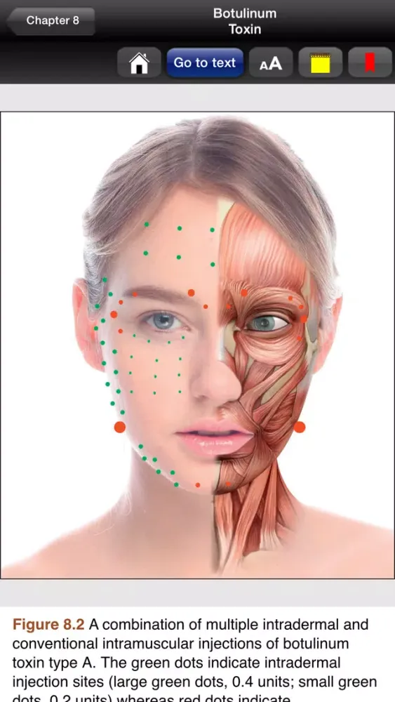 Ảnh chụp màn hình của Botulinum Toxin, 3rd Edition