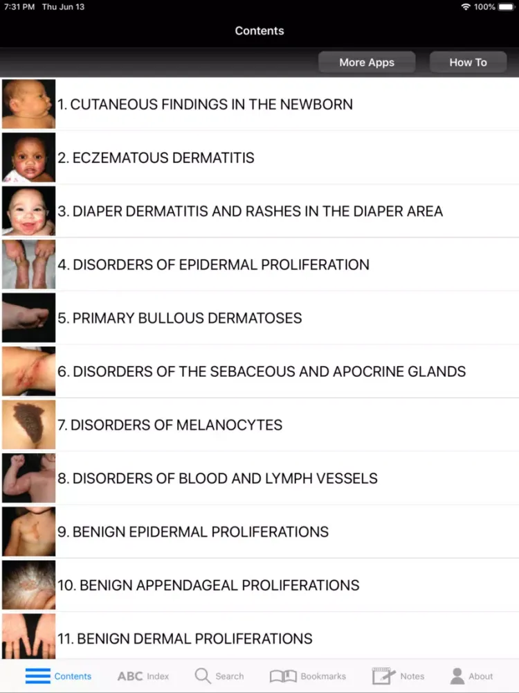 Atlas & Synopsis Ped Derm 2/E iPad 应用截图