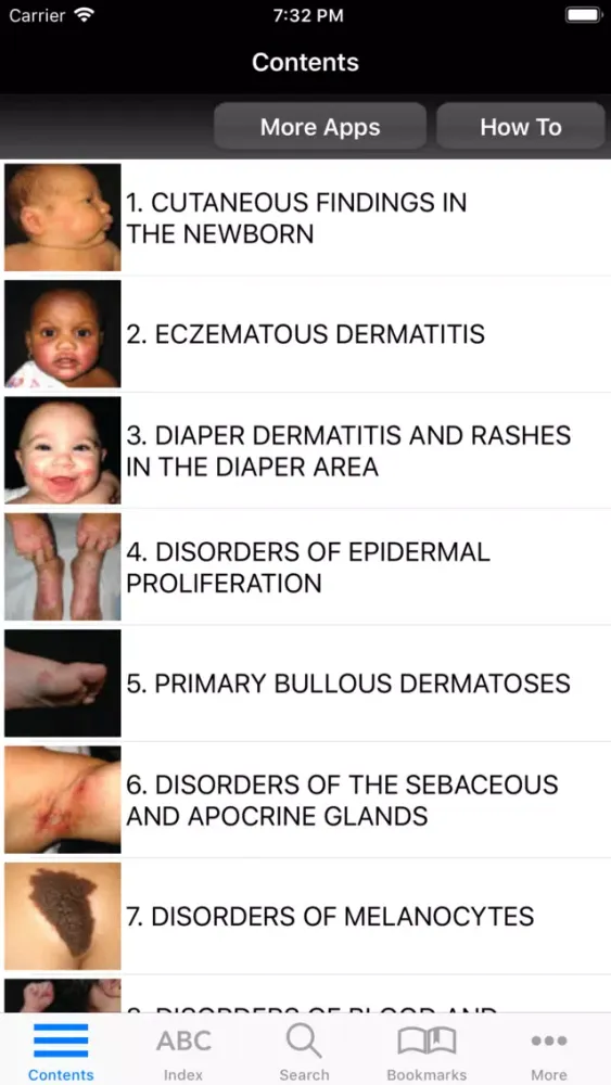 Atlas & Synopsis Ped Derm 2/E应用截图