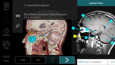 Capturas de tela do For Organizations - 2017 Human Anatomy Atlas