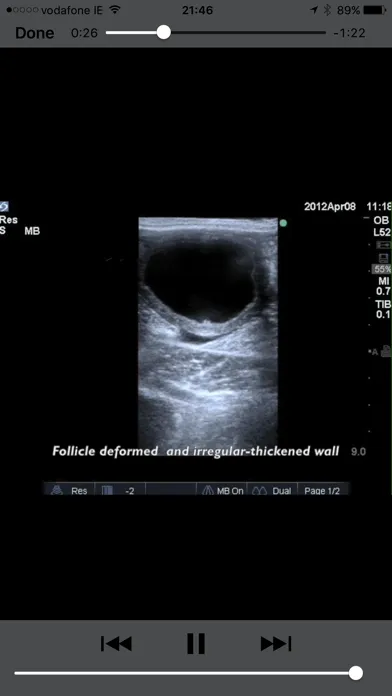 Equine Reproductive Ultrasound スクリーンショット