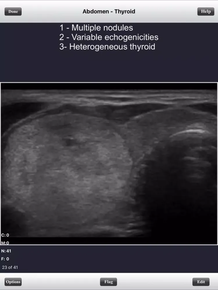 صور ARDMS Abdomen Ultrasound Flashcards for Boards iPad 