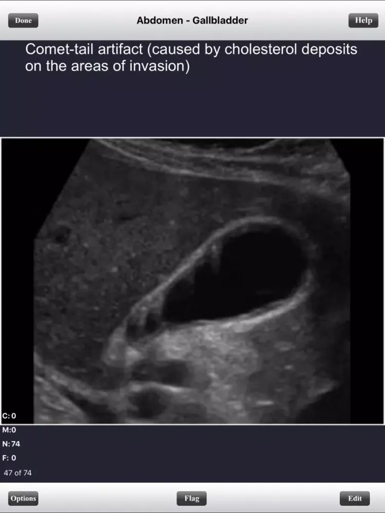 صور ARDMS Abdomen Ultrasound Flashcards for Boards iPad 