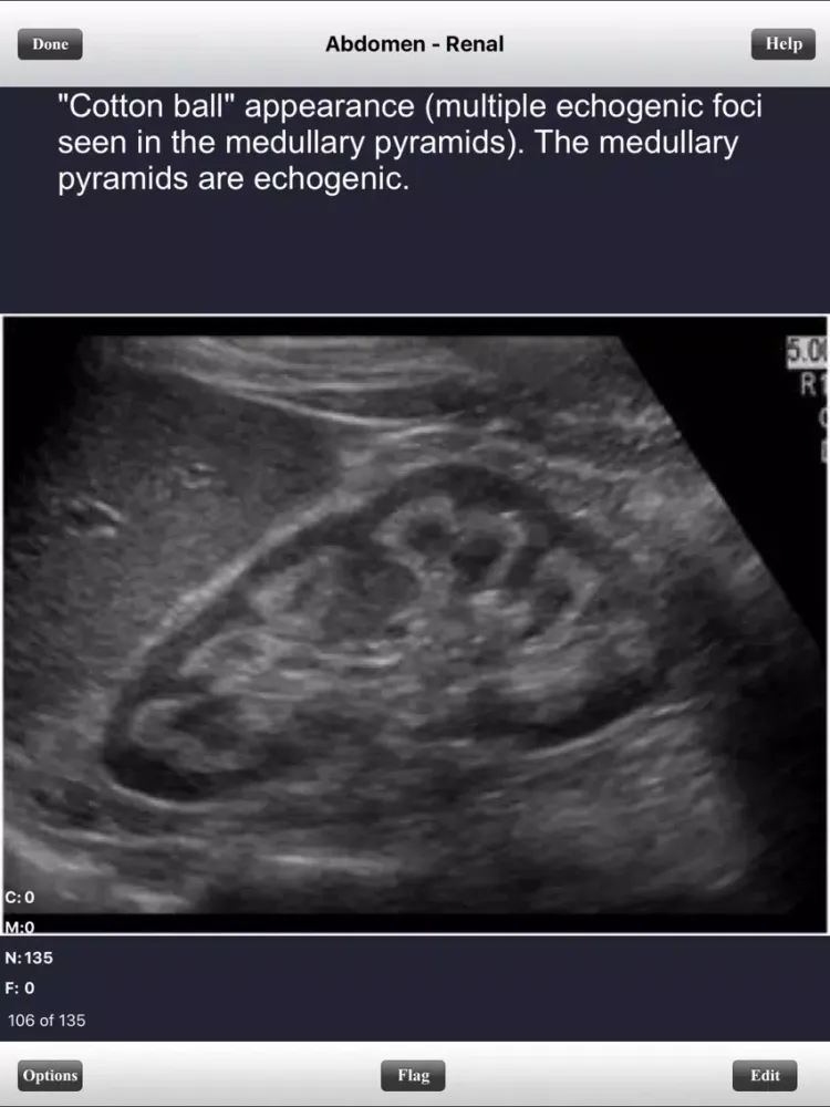 صور ARDMS Abdomen Ultrasound Flashcards for Boards iPad 
