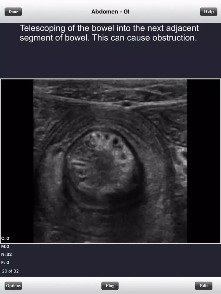 صور ARDMS Abdomen Ultrasound Flashcards for Boards iPad 