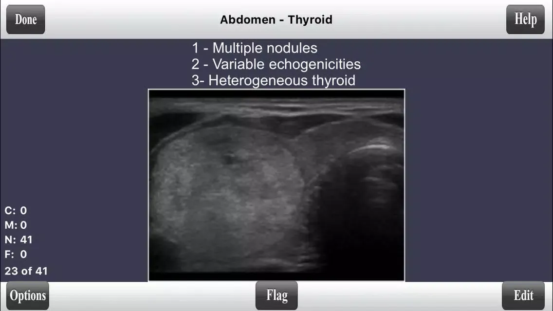 صور ARDMS Abdomen Ultrasound Flashcards for Boards