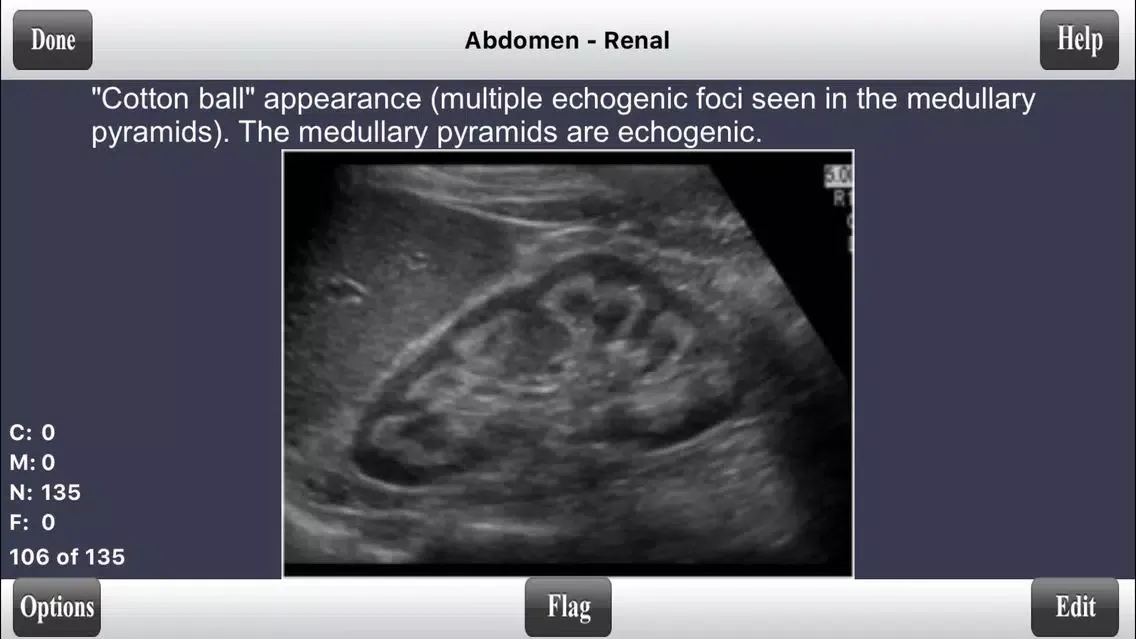 صور ARDMS Abdomen Ultrasound Flashcards for Boards