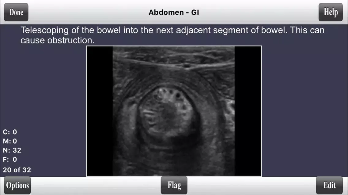 صور ARDMS Abdomen Ultrasound Flashcards for Boards