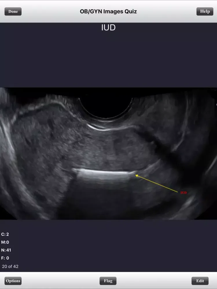 ARDMS OBGYN Ultrasound Flashcards for ARDMS OB/GYN Board Review iPad スクリーンショット